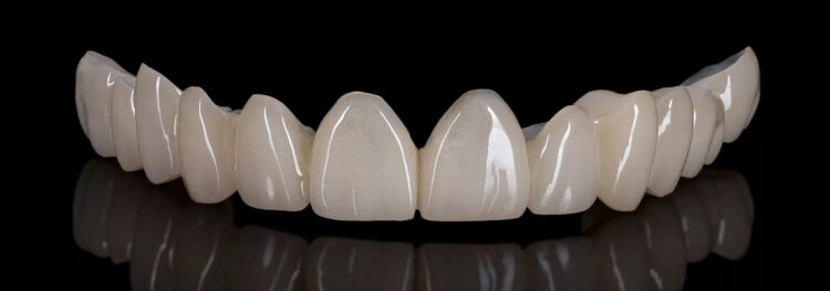 Transforming Smiles with Basal Implants & Zirconia Crowns
