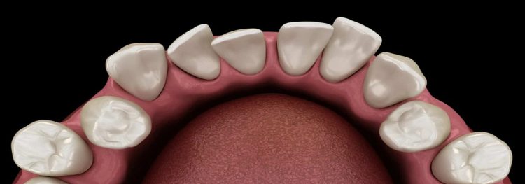 How Teeth Alignment Affects Speech and Performance