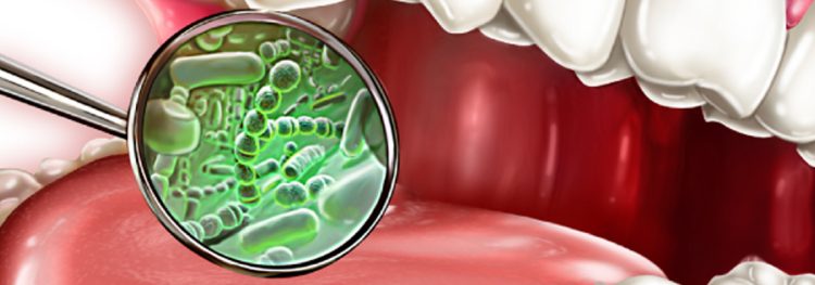 Oral Microbiome Management: Good and Bad Bacteria in Your Mouth