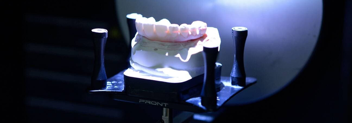 How 3D Printing is Revolutionizing Dental Implants