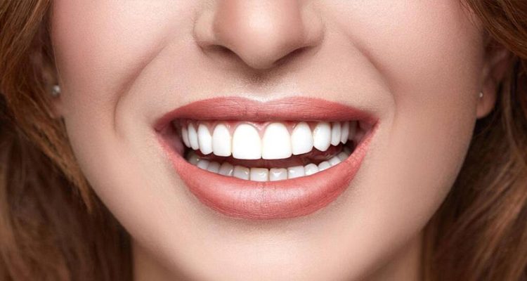 Affordable Smile Makeovers: Beauty Without the High Cost