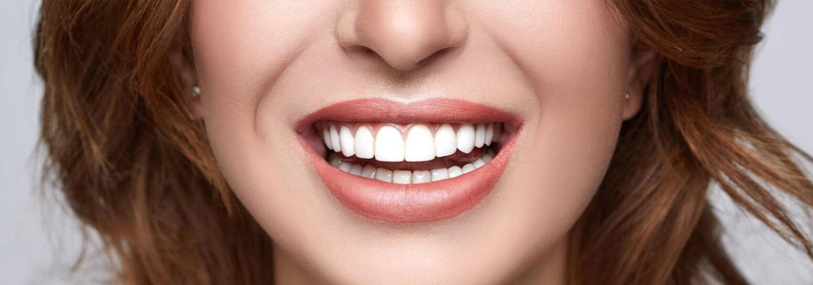 Affordable Smile Makeovers: Beauty Without the High Cost